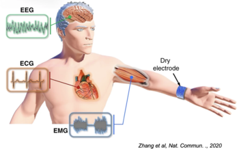Flexible microneedle electrodes enabling precise, invasive and long-term biopotential monitoring.
