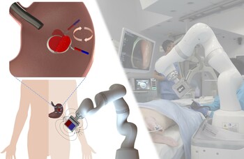 "Invisible hands" perform dexterous tissue manipulation in endoluminal surgery