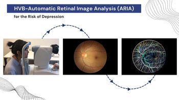 AI-based automatic retinal image analysis (ARIA) for detecting depression risk in adults