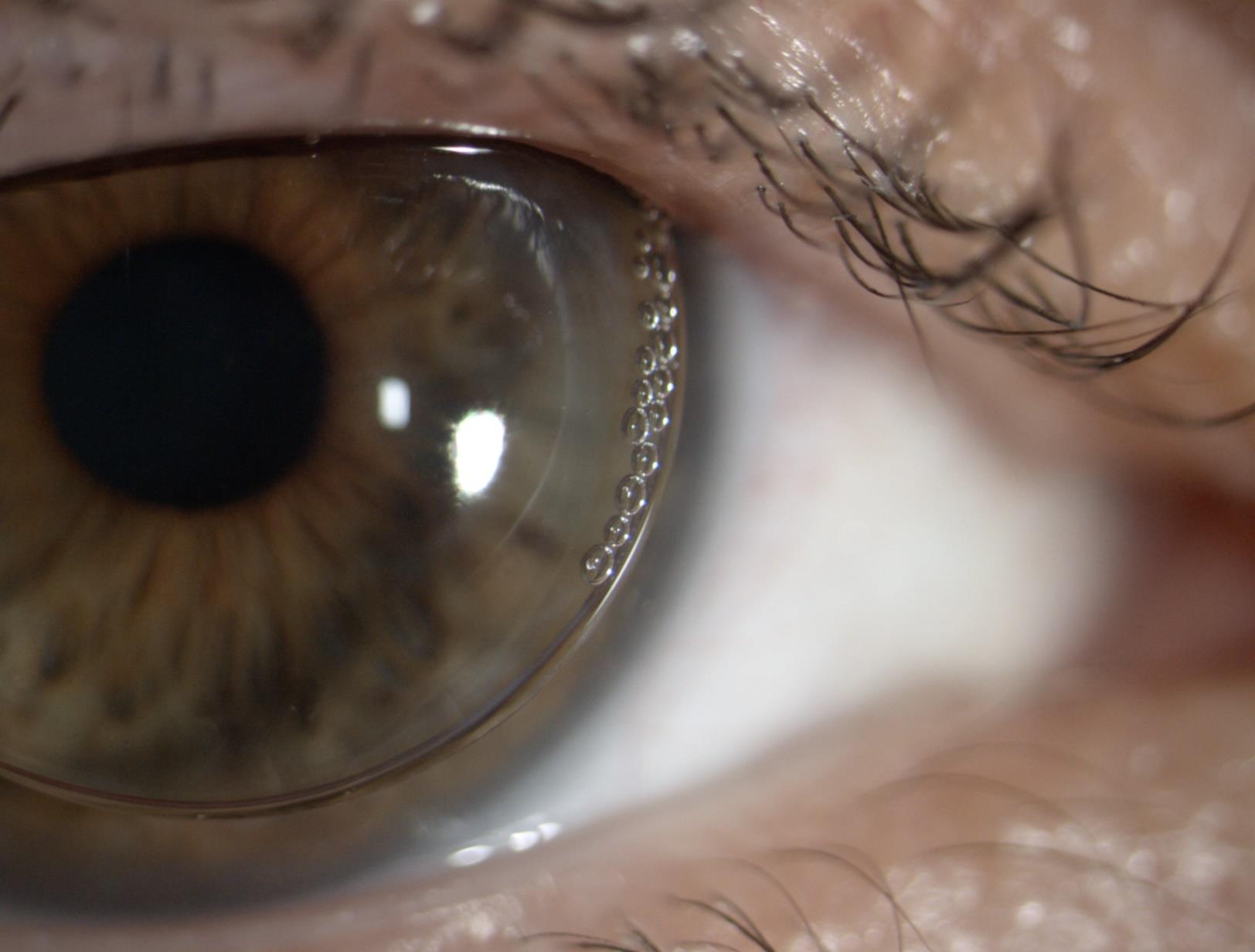 Bijoux de lentille @Sylvie Cimetière  