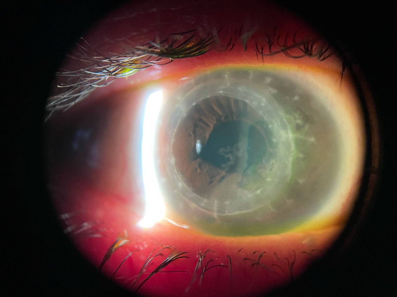 Armagedon @Réouven Derhy