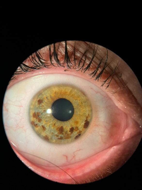 Pigments gravitationnels @Aurélien Masson