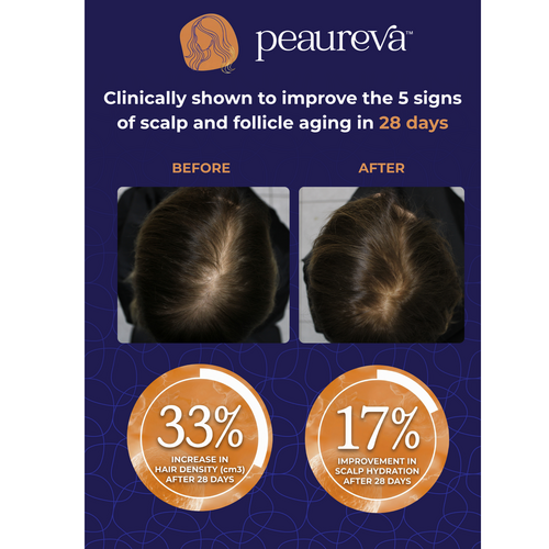 Peaureva™