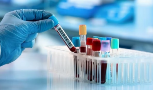 BTS Biologie Médicale